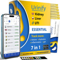 Mobile App Urine Test Strips for Kidney and Liver Health